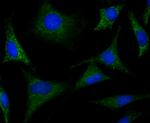 CRMP1 Recombinant Rabbit Monoclonal Antibody (JU73-30)
