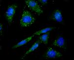 PRKD2 Recombinant Rabbit Monoclonal Antibody (JU08-33)