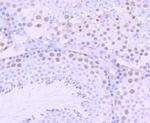 DKC1 Antibody in Immunohistochemistry (Paraffin) (IHC (P))