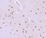 ILF2 Antibody in Immunohistochemistry (Paraffin) (IHC (P))