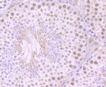 ILF2 Antibody in Immunohistochemistry (Paraffin) (IHC (P))