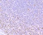 ILF2 Antibody in Immunohistochemistry (Paraffin) (IHC (P))