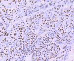 ILF2 Recombinant Rabbit Monoclonal Antibody (JU50-33)