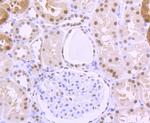 ILF2 Antibody in Immunohistochemistry (Paraffin) (IHC (P))