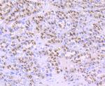 PSME1 Antibody in Immunohistochemistry (Paraffin) (IHC (P))