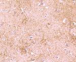 DDX6 Antibody in Immunohistochemistry (Paraffin) (IHC (P))