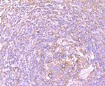 DDX6 Antibody in Immunohistochemistry (Paraffin) (IHC (P))