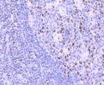 DNA Ligase I Recombinant Rabbit Monoclonal Antibody (JB43-39)