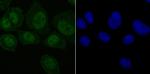 SET Recombinant Rabbit Monoclonal Antibody (JB60-34)