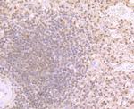 PSMB9 Recombinant Rabbit Monoclonal Antibody (JB35-07)