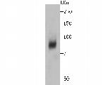 DCP1A Antibody in Western Blot (WB)