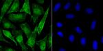 Phospho-alpha Synuclein (Ser129) Recombinant Rabbit Monoclonal Antibody (JB22-44)
