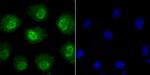 Phospho-alpha Synuclein (Ser129) Antibody in Immunocytochemistry (ICC/IF)