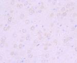 Furin Antibody in Immunohistochemistry (Paraffin) (IHC (P))