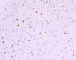 BCL11A Antibody in Immunohistochemistry (Paraffin) (IHC (P))
