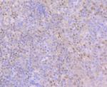 BCL11A Antibody in Immunohistochemistry (Paraffin) (IHC (P))