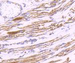 PDK2 Recombinant Rabbit Monoclonal Antibody (JB66-93)