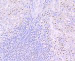 PU.1 Antibody in Immunohistochemistry (Paraffin) (IHC (P))