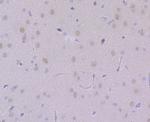 USP7 Antibody in Immunohistochemistry (Paraffin) (IHC (P))