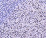 USP7 Recombinant Rabbit Monoclonal Antibody (JB80-36)