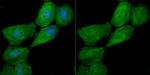 Galectin 7 Antibody in Immunocytochemistry (ICC/IF)
