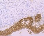 Galectin 7 Antibody in Immunohistochemistry (Paraffin) (IHC (P))