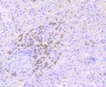 CD3 Antibody in Immunohistochemistry (Paraffin) (IHC (P))