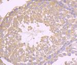 NPC1 Antibody in Immunohistochemistry (Paraffin) (IHC (P))