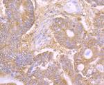 CD205 Recombinant Rabbit Monoclonal Antibody (JB87-35)