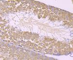 STIP1 Antibody in Immunohistochemistry (Paraffin) (IHC (P))
