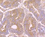 STIP1 Antibody in Immunohistochemistry (Paraffin) (IHC (P))
