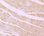 Desmoglein 2 Antibody in Immunohistochemistry (Paraffin) (IHC (P))