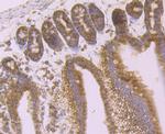 Desmoglein 2 Antibody in Immunohistochemistry (Paraffin) (IHC (P))