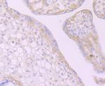 Desmoglein 2 Antibody in Immunohistochemistry (Paraffin) (IHC (P))