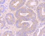 Desmoglein 2 Antibody in Immunohistochemistry (Paraffin) (IHC (P))