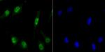 MCM3 Recombinant Rabbit Monoclonal Antibody (JB99-35)