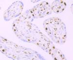 MCM3 Antibody in Immunohistochemistry (Paraffin) (IHC (P))