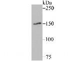 MYBBP1A Recombinant Rabbit Monoclonal Antibody (JB40-09)