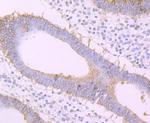 FZD8 Recombinant Rabbit Monoclonal Antibody (JB40-16)