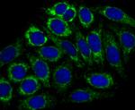 CPS1 Recombinant Rabbit Monoclonal Antibody (JB40-33)