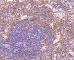 CD27 Antibody in Immunohistochemistry (Paraffin) (IHC (P))