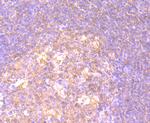 CD27 Antibody in Immunohistochemistry (Paraffin) (IHC (P))