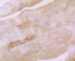 EEF1A1 Antibody in Immunohistochemistry (Paraffin) (IHC (P))