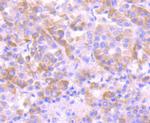 EEF1A1 Antibody in Immunohistochemistry (Paraffin) (IHC (P))