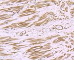 H-cadherin Recombinant Rabbit Monoclonal Antibody (JB14-48)