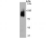 BCL6 Recombinant Rabbit Monoclonal Antibody (JB18-48)