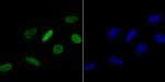 H4K16ac Recombinant Rabbit Monoclonal Antibody (JB21-44)