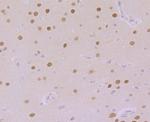 CaMKIV Antibody in Immunohistochemistry (Paraffin) (IHC (P))