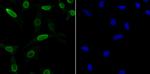 SNRPA Recombinant Rabbit Monoclonal Antibody (JB33-48)