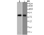 PARP2 Recombinant Rabbit Monoclonal Antibody (JG34-56)